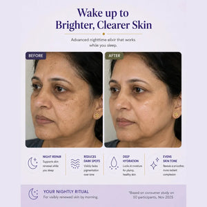Before and after skin improvement advertisement with a woman's face on a light purple background.